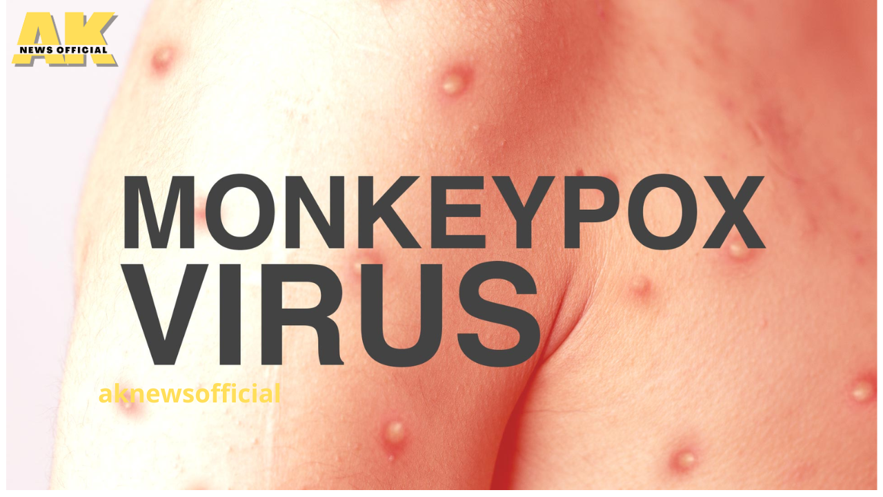 aknewsofficial monkeypox